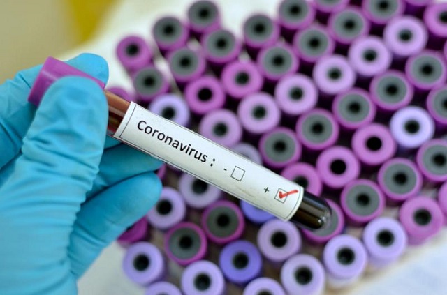 Coronavirus : Un 3e décès et 4 provinces touchées